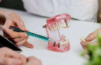 A dentis explaining dental implants to a patient.
