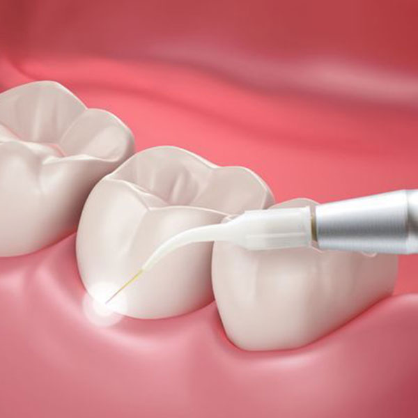 periodontal care
