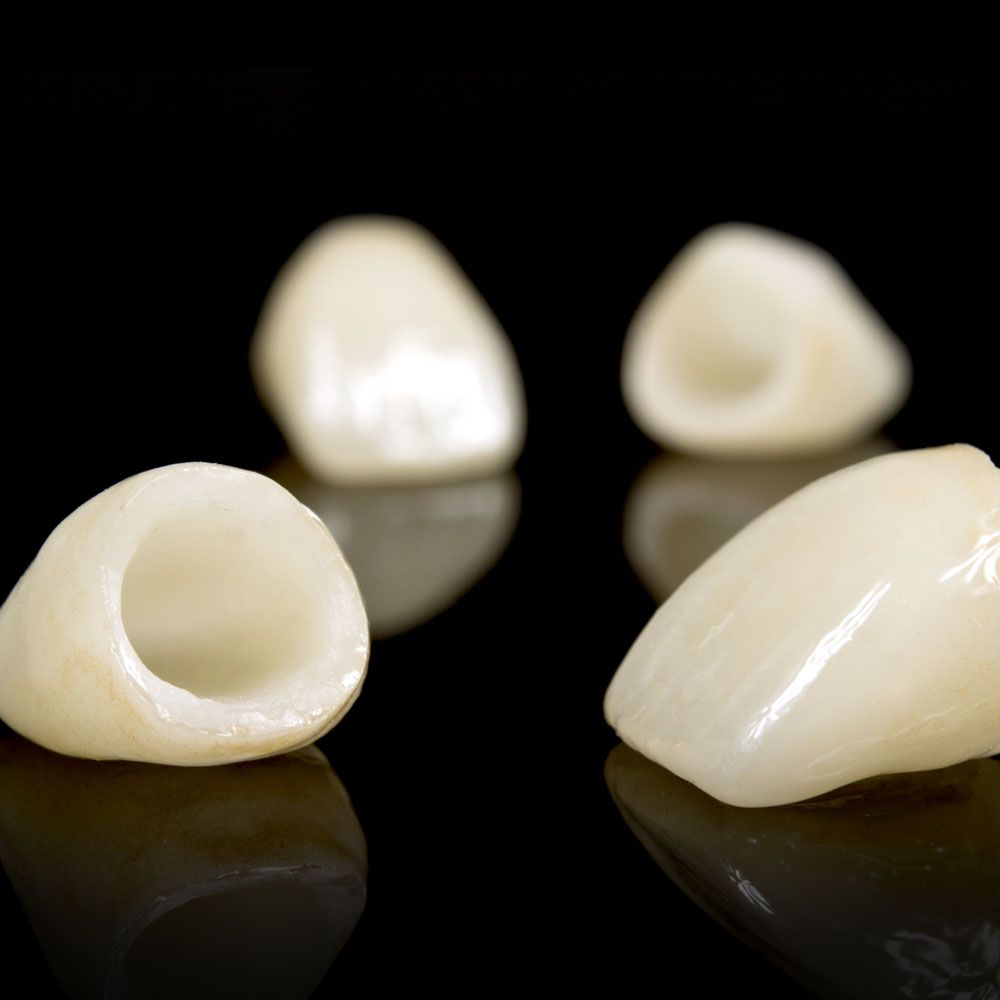 dental crowns